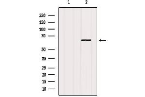 Western Blotting (WB) image for anti-Estrogen Receptor 1 (ESR1) (C-Term) antibody (ABIN6261610)