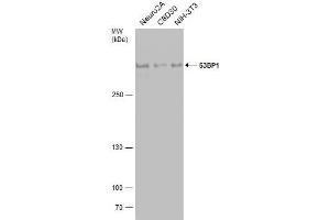 Western Blotting (WB) image for anti-Tumor Protein P53 Binding Protein 1 (TP53BP1) (N-Term) antibody (ABIN2855433)
