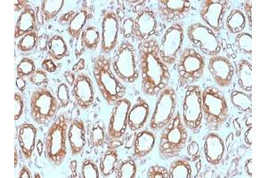 ABIN6383807 to Calnexin was successfully used to stain epithelial cells perinuclear in human renal carcinoma sections. (Calnexin 抗体  (Lumenal Region))