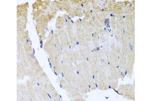 Immunohistochemistry of paraffin-embedded Mouse heart using RAB24 Polyclonal Antibody at dilution of 1:100 (40x lens). (RAB24 抗体)
