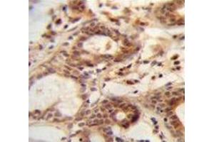 Immunohistochemistry (Paraffin-embedded Sections) (IHC (p)) image for anti-Nudix (Nucleoside Diphosphate Linked Moiety X)-Type Motif 15 (NUDT15) (AA 89-118), (C-Term) antibody (ABIN953779)