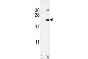 Western blot analysis of IL17F antibody and 293 cell lysate (2 ug/lane) either nontransfected (Lane 1) or transiently transfected with the IL17F gene (2). (IL17F 抗体  (AA 16-45))
