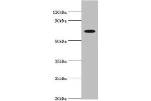 Western blot All lanes: Long-chain fatty acid transport protein 4 antibody at 8 μg/mL + Mouse heart tissue Secondary Goat polyclonal to rabbit IgG at 1/10000 dilution Predicted band size: 73, 27 kDa Observed band size: 73 kDa (SLC27A4 抗体  (AA 494-643))