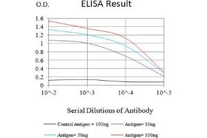 Black line: Control Antigen (100 ng),Purple line: Antigen (10 ng), Blue line: Antigen (50 ng), Red line:Antigen (100 ng) (SARS-Cov2-NP1 (AA 1-180) 抗体)
