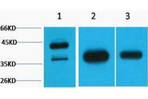 Western Blotting (WB) image for anti-Growth Associated Protein 43 (GAP43) antibody (ABIN3181291) (GAP43 抗体)