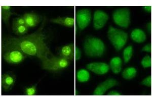 Immunofluorescence microscopy anti -THRB1 (Thyroid hormone receptor Beta 1) antibody  Tissue: Mouse Dendritic cells Primary antibody: Anti THRB1 1:100 1 hr PBS 3% BSA (left) Normal rabbit IgG isotype control (right) Secondary Ab: 488 dye conjugate 1:1000 1 hr Mounting: Fluoromount-G (Southern Biotechnology Associates, Birmingham, AL) for examination. (THRB 抗体  (N-Term))