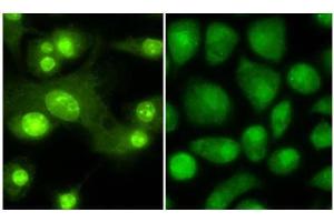 Immunofluorescence microscopy anti -THRB1 (Thyroid hormone receptor Beta 1) antibody  Tissue: Mouse Dendritic cells Primary antibody: Anti THRB1 1:100 1 hr PBS 3% BSA (left) Normal rabbit IgG isotype control (right) Secondary Ab: 488 dye conjugate 1:1000 1 hr Mounting: Fluoromount-G (Southern Biotechnology Associates, Birmingham, AL) for examination.