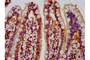 IHC image of ABIN7148695 diluted at 1:300 and staining in paraffin-embedded human small intestine tissue performed on a Leica BondTM system. (MUS81 抗体  (AA 82-265))