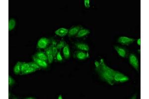 Immunofluorescent analysis of Hela cells using ABIN7143158 at dilution of 1:100 and Alexa Fluor 488-congugated AffiniPure Goat Anti-Rabbit IgG(H+L) (TRIP4 抗体  (AA 360-535))