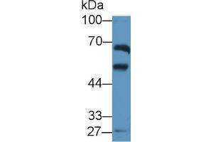 Detection of ALDH1A2 in Rat Testis lysate using Polyclonal Antibody to Aldehyde Dehydrogenase 1 Family, Member A2 (ALDH1A2) (ALDH1A2 抗体  (AA 1-422))