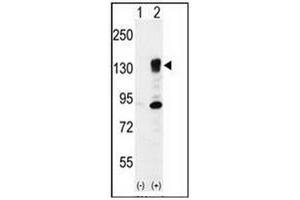 Western blot analysis of ITGA5 (arrow) using CD49e / ITGA5 Antibody (Center) Cat. (ITGA5 抗体  (Middle Region))