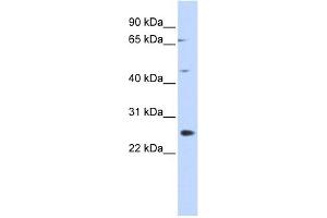 SPATA22 antibody used at 1 ug/ml to detect target protein. (SPATA22 抗体  (N-Term))