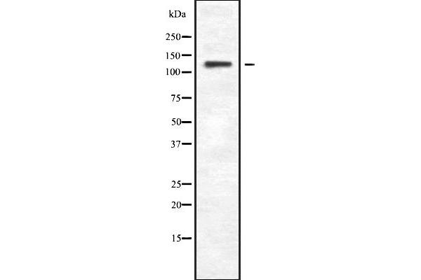 Phospholipase C beta 4 抗体  (Internal Region)