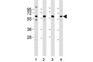 Western blot testing of Pyruvate Kinase antibody at 1:2000 dilution. (PKM2 抗体  (AA 121-151))