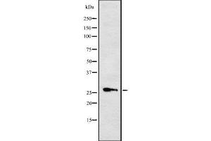Western blot analysis of Cytochrome b561 using RAW264. (CYB561 抗体  (Internal Region))