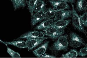 Immunofluorescence staining of HeLa cells (Human cervical epitheloid carcinoma, ATCC CCL-2. (VCP 抗体  (AA 9-130))
