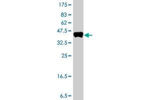 Western Blot detection against Immunogen (37. (AGTPBP1 抗体  (AA 1087-1186))