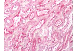 Human Kidney: Formalin-Fixed, Paraffin-Embedded (FFPE) (GPR84 抗体  (Cytoplasmic Domain))