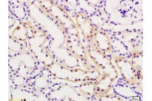 Formalin-fixed and paraffin embedded rat kidney tissue labeled with Anti-TIMP-2 Polyclonal Antibody , Unconjugated at 1:200, followed by conjugation to the secondary antibody and DAB staining (TIMP2 抗体  (AA 131-220))