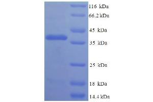 FIBIN Protein (AA 19-211) (His-SUMO Tag)