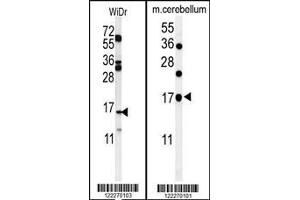 (LEFT)Western blot analysis of TPPP3 Antibody in WiDr cell tissue lysates (35ug/lane). (TPPP3 抗体  (C-Term))