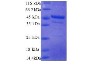 Ribosomal Protein S10 (RPS10) (AA 4-165), (partial) protein (GST tag) (RPS10 Protein (AA 4-165, partial) (GST tag))
