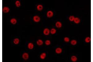 ABIN6266654 staining COS7 by IF/ICC. (PIAS2 抗体)