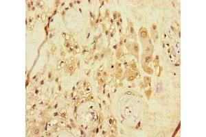 Immunohistochemistry of paraffin-embedded human placenta tissue using ABIN7167986 at dilution of 1:100 (ARHGEF5 抗体  (AA 433-507))