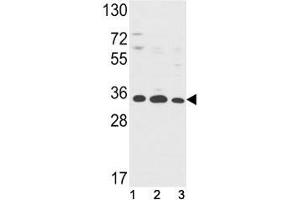 Western blot analysis of Annexin V antibody and (1) HepG2, (2) A2058, (3) T47D lysate. (Annexin V 抗体  (AA 1-30))