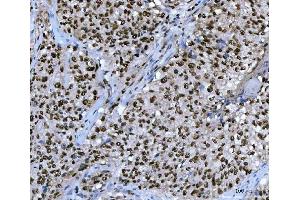 IHC analysis of UBC12/UBE2M using anti-UBC12/UBE2M antibody (ABIN7600885). (UBE2M 抗体  (AA 25-154))