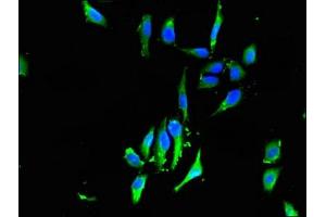Immunofluorescent analysis of Hela cells using ABIN7153129 at dilution of 1:100 and Alexa Fluor 488-congugated AffiniPure Goat Anti-Rabbit IgG(H+L) (FHL1 抗体  (AA 13-240))