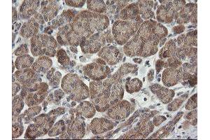 Image no. 5 for anti-Chromosome 2 Open Reading Frame 62 (C2orf62) antibody (ABIN1497053) (C2orf62 抗体)