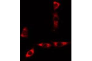 ABIN6277564 staining A549 cells by IF/ICC. (CYB5A 抗体  (Internal Region))