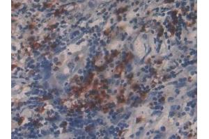 Immunohistochemistry (IHC) image for anti-Matrix Metallopeptidase 9 (Gelatinase B, 92kDa Gelatinase, 92kDa Type IV Collagenase) (MMP9) (AA 213-399) antibody (ABIN7432013)