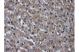 Immunohistochemical staining of paraffin-embedded liver tissue using anti-DCXRmouse monoclonal antibody. (DCXR 抗体)
