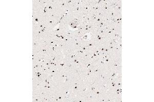 Immunohistochemical analysis of paraffin-embedded Human brain tissue using (ABIN650833 and ABIN2839800) performed on the Leica® BOND RXm. (MECP2 抗体  (pSer423))