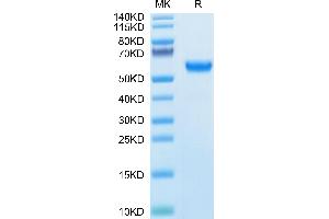 Osteopontin Protein (AA 17-300) (His tag)