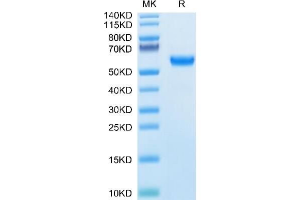 Osteopontin Protein (AA 17-300) (His tag)