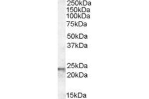 Western Blotting (WB) image for anti-Transgelin (TAGLN) (C-Term) antibody (ABIN185188)