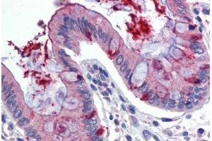 Human Colon (formalin-fixed, paraffin-embedded) stained with LIN7C antibody ABIN462236 followed by biotinylated goat anti-rabbit IgG secondary antibody ABIN481713, alkaline phosphatase-streptavidin and chromogen. (LIN7C 抗体  (N-Term))