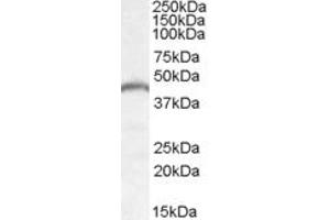 Western Blotting (WB) image for anti-Patatin-Like phospholipase Domain Containing 3 (PNPLA3) (AA 186-197) antibody (ABIN1493896) (PNPLA3 抗体  (AA 186-197))