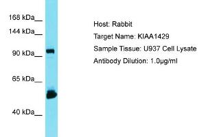 Host: Rabbit Target Name: KIAA1429 Sample Type: U937 Whole Cell lysates Antibody Dilution: 1. (VIRMA/KIAA1429 抗体  (C-Term))