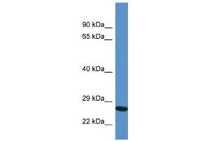 Western Blot showing YIPF4 antibody used at a concentration of 1. (YIPF4 抗体  (N-Term))