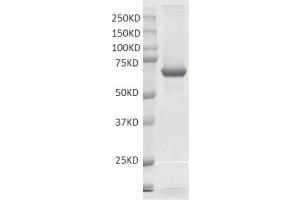 Recombinant PRMT3 protein gel.