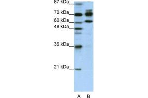 Western Blotting (WB) image for anti-Adenosine Deaminase, RNA-Specific, B1 (ADARB1) antibody (ABIN2462101) (RED1 抗体)