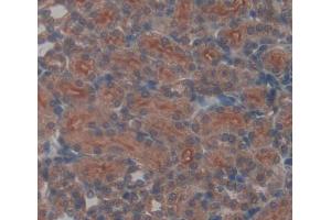Used in DAB staining on fromalin fixed paraffin- embedded kidney tissue (UQCRB 抗体  (AA 4-111))