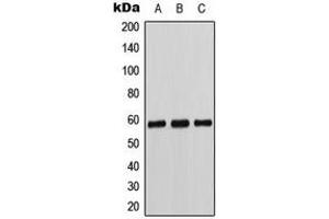 Western blot analysis of Cytochrome P450 11B1/2 expression in K562 (A), Caki1 (B), MCF7 (C) whole cell lysates.