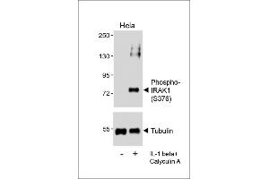 Western blot analysis of lysates from Hela cell line, untreated or treated with IL-1 beta(20 ng/mL) + Calyculin A(100nM), using (ABIN6241064 and ABIN6578961) (upper) or Tubulin (lower). (IRAK1 抗体  (pSer376))