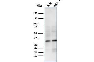 Western Blot Analysis of PC3 and MCF-7 cell lysate using NKX2. (Recombinant NKX2-8 抗体  (AA 10-123))