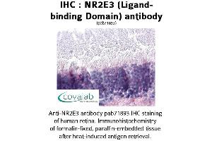 Image no. 1 for anti-Nuclear Receptor Subfamily 2, Group E, Member 3 (NR2E3) antibody (ABIN1737507) (NR2E3 抗体)
